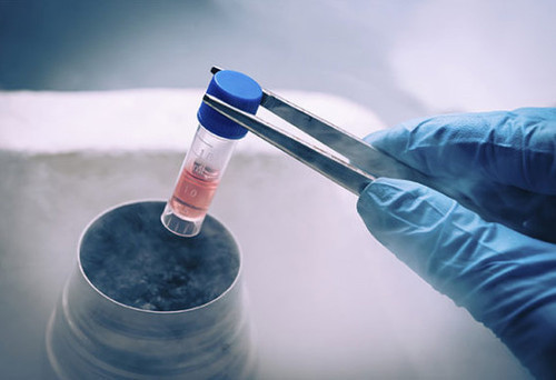 Tüp bebekte sperm az veya yoksa ne yapılır? Cinsel ilişki sakancalı mı? - Resim: 3