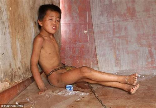 Amcası 12 yaşındaki çocuğu tasmaladı - Resim: 2