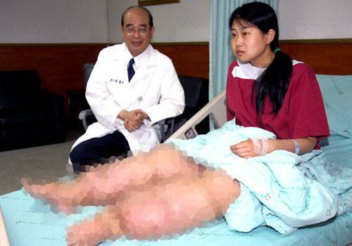 İnanması zor tıbbi vakalar - Resim: 2