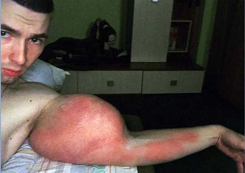 Tam bir felaket kolları bakın neden bu hale geldi - Resim: 1