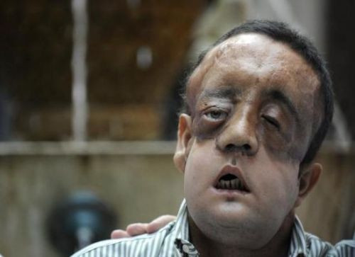 İlk kez insan içine çıktı! - Resim: 3