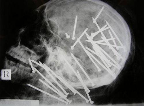 Bu röntgenler çok şaşırtacak  - Resim: 4