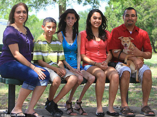 Genç kız zayıflığıyla görenleri hayrete düşürdü - Resim: 4