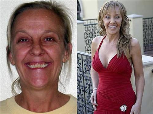 Zorla güzellik olmaz demeyin! - Resim: 2