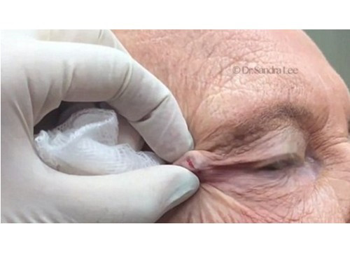 Siyah nokta sandı ama bakın ne çıktı? - Resim: 2