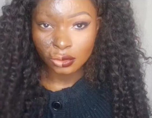 Doktorların yapamadığını kendisi yaptı! Şok olacaksınız - Resim: 4