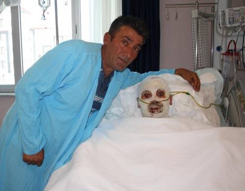 Mucize deri nakli - Resim: 4