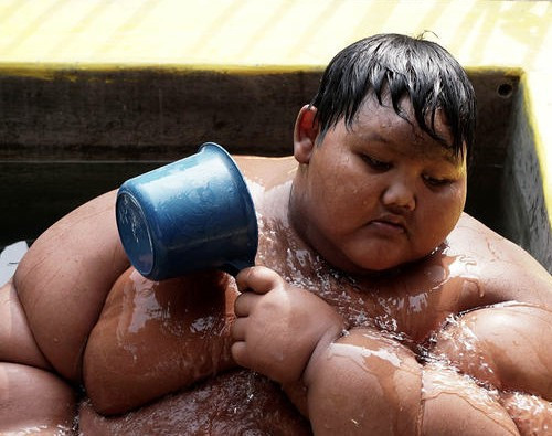 Günde 5 öğün pilav yiyerek bu hale geldi! Şuna bakın... - Resim: 3