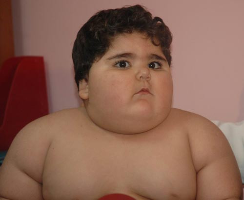 2 yaşındaki Sümeyye tam 33 kilo - Resim: 1