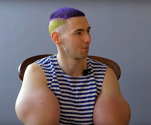 Tam bir felaket kolları bakın neden bu hale geldi - Resim: 2