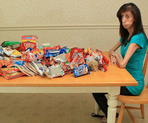 Genç kız zayıflığıyla görenleri hayrete düşürdü - Resim: 2