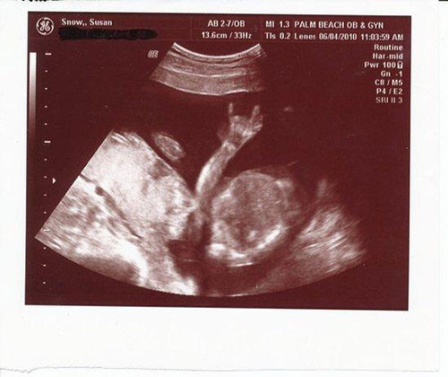 Ultrasonda bebek görüntüsü yerine çıkan şeyler - Resim: 1