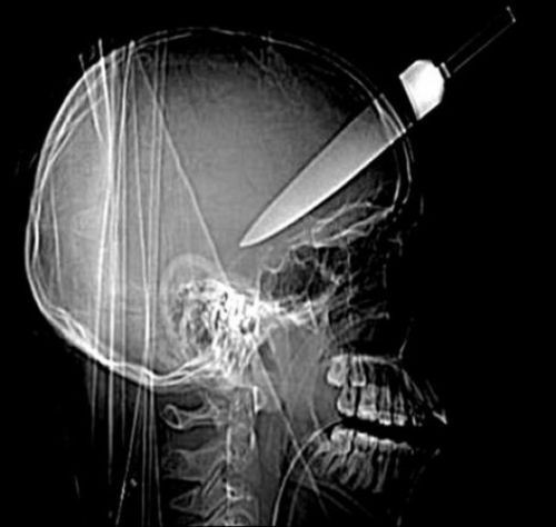 Bu röntgenler çok şaşırtacak  - Resim: 3
