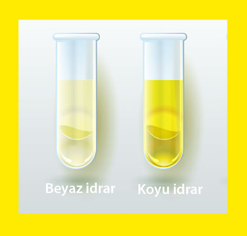 İdrar rengi neyin belirtisi kırmızı ve bordo renkli idrar kötü hastalık - Resim: 4