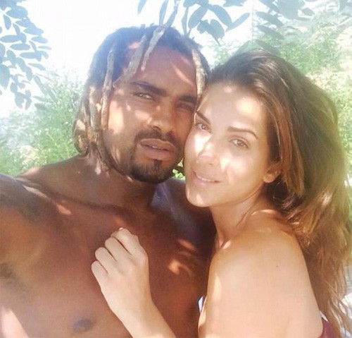 Erkek arkadaşı ünlü modelin yüzüne asit attı - Resim: 1