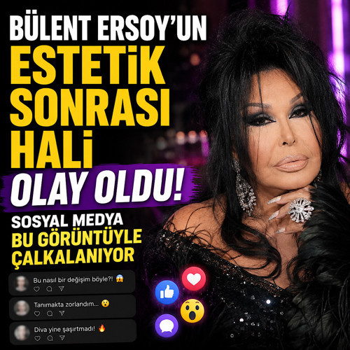 Bülent Ersoy’un estetik sonrası hali olay oldu! Sosyal medya bu görüntüyle çalkalanıyor