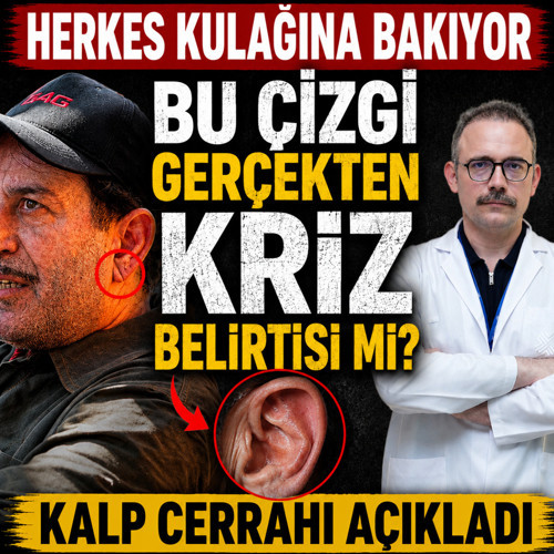 Kulak çizgisi gerçekten kalp krizi belirtisi mi? Cem Yılmaz'da görüldü doktor açıkladı