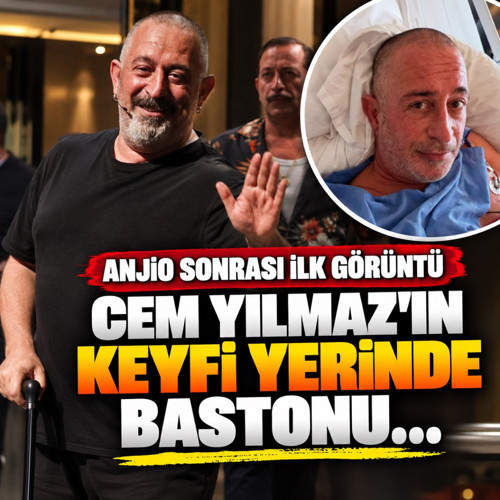 Anjio sonrası ilk görüntü! Cem Yılmaz'ın keyfi yerinde bastonu...