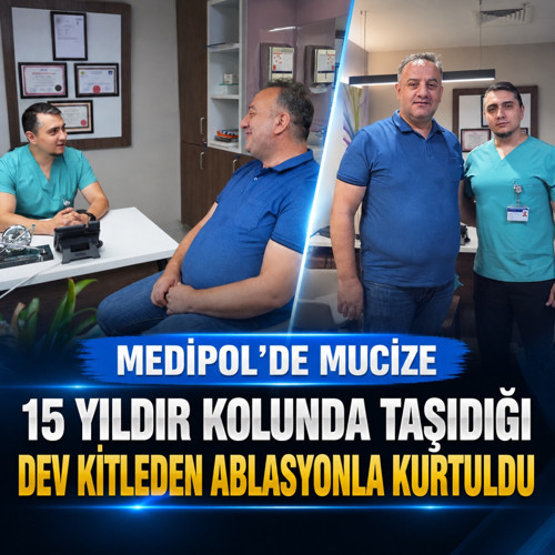 Medipol’de mucize gibi yaşam! 15 yıldır kolunda taşıdığı dev kitleden ablasyonla kurtuldu