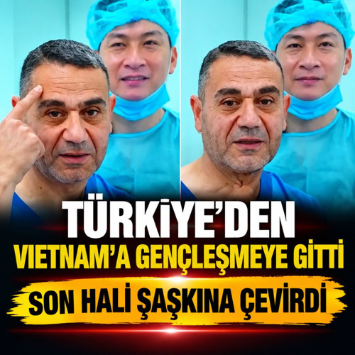 Türkiye'den Vietnam'a gençleşmeye gitti! Son hali şaşkına çevirdi