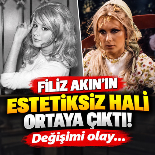 Filiz Akın'ın estetiksiz hali ortaya çıktı! Değişimi olay