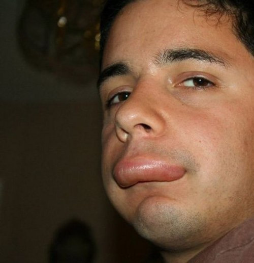 Arı sokması moda oldu! - Resim: 4