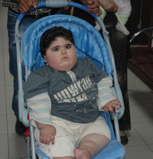 2 yaşındaki Sümeyye tam 33 kilo - Resim: 2