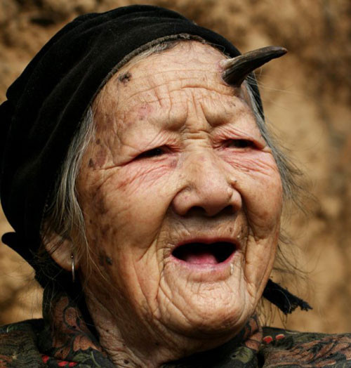 Bu kadının alnında boynuzları var - Resim: 2