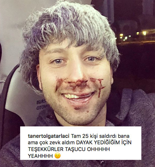 Survivor Taner Tarlacı kafayı sıyırmış fena dayak yedi bakın ne paylaştı - Resim: 2