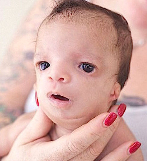 Aile bebeği görünce hastaneden kaçtılar bir de sonra olanlara bakın - Resim: 1