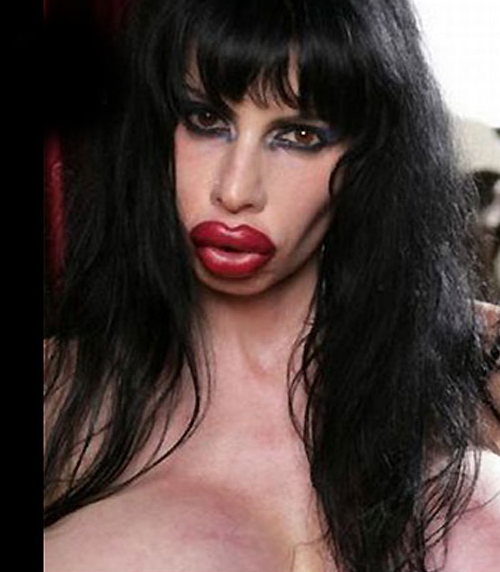 Estetik sonrası faciaya dönüştüler - Resim: 4