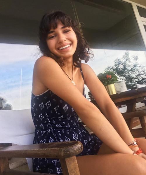 Barbie bebeği andıran yüzüyle dikkat çekmişti! Sebebi bakın neymiş... - Resim: 3