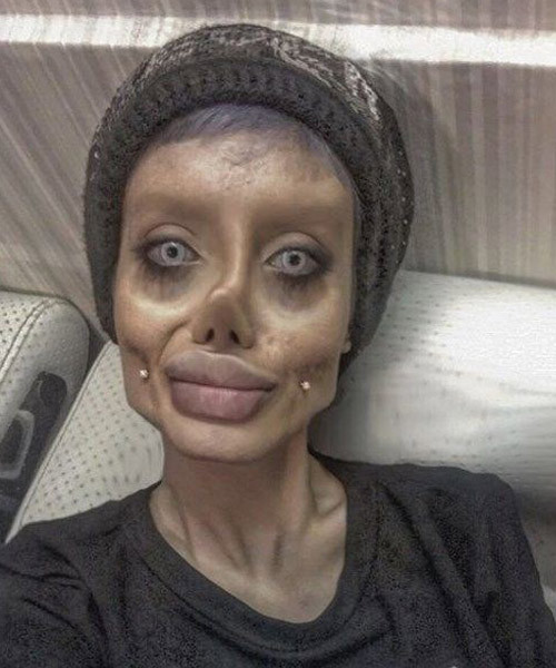 Angelina Jolie'ye benzemeye çalışan İranlı kadının son hali şoke etti! - Resim: 2