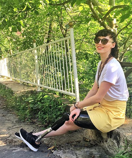 Kanser ondan bacağını almıştı Neslihan Tay 3. kez kansere yakalandı! - Resim: 2