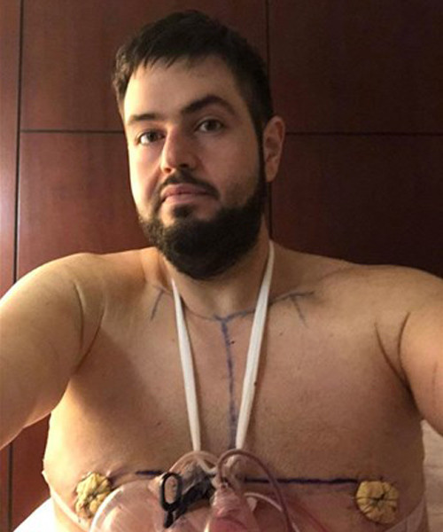 244 kilodan 136 kiloya düştü bambaşka birine döndü! Son haline bakın... - Resim: 4