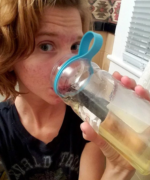 Bu kadarına da pes doğrusu güzelleşmek için yaptıkları şeye bakın! - Resim: 3