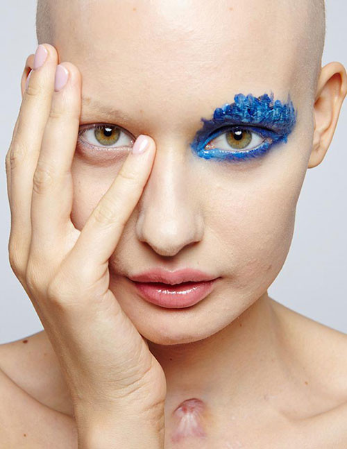 Genç model kanser oldu ama vazgeçmedi - Resim: 2