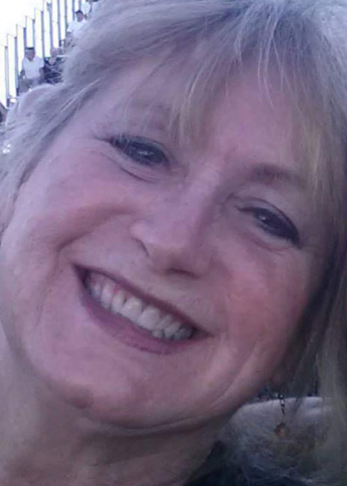 Göğüslerini küçültmek için bıçak altına yattı üçüncü memesi çıktı!  - Resim: 3