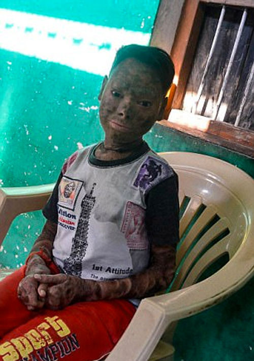 Dünya onu konuşuyordu yılan kızın son haline bakın - Resim: 4