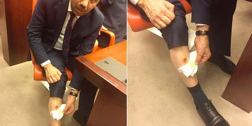 CHP'li vekil kürsüde pantalonun paçasını açıp gösterdi - Resim: 1