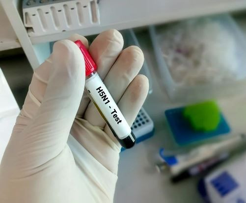 Dünyada panik yaratan haber: Kuş gribi mutasyona uğradı! Daha ölümcül ve bulaşıcı... - Resim: 1