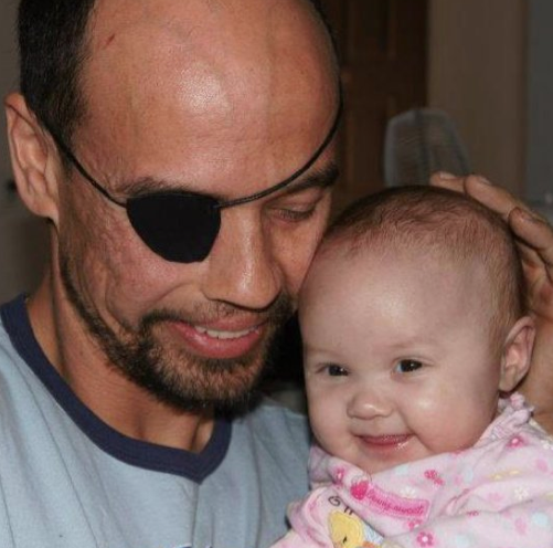 Bu insanlar mucize eseri yaşıyor - Resim: 1