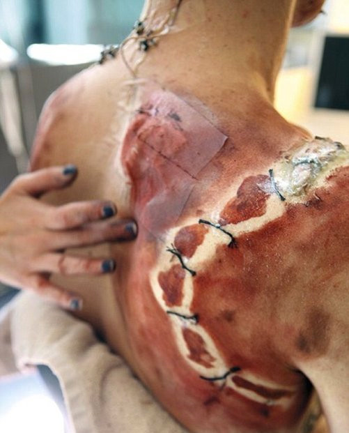 Ünlü oyuncuyu bu hale getirdiler herkes hayrete düştü  - Resim: 1