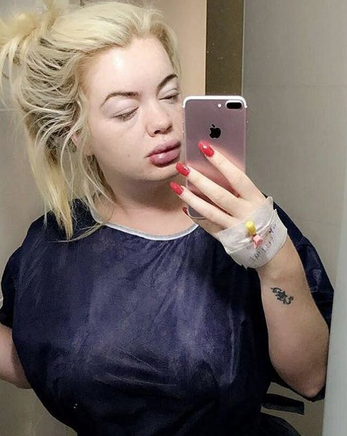 Loto milyonerinin değişimi dudak uçuklattı! Son hali olay - Resim: 1