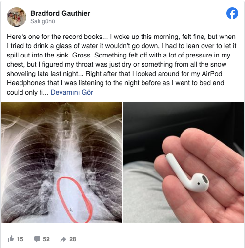 Doktora gitti, kulaklığını yuttuğu ortaya çıktı - Resim: 0