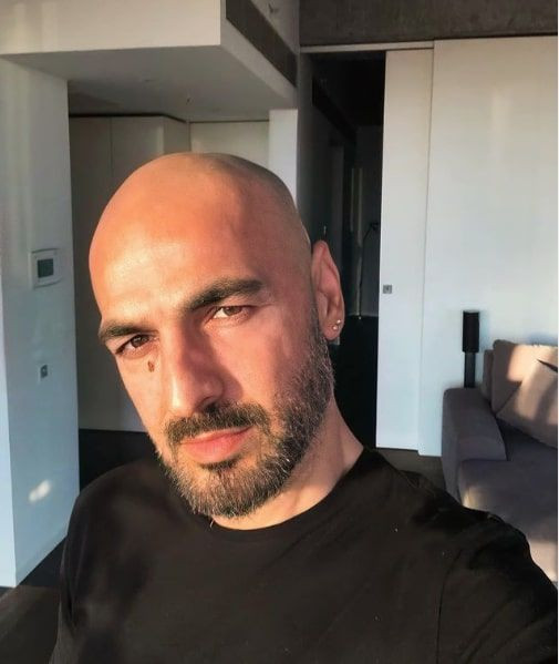 Soner Sarıkabadayı'nın uzun saçlı hali şoke etti hiç böyle görmemiştik! - Resim: 2