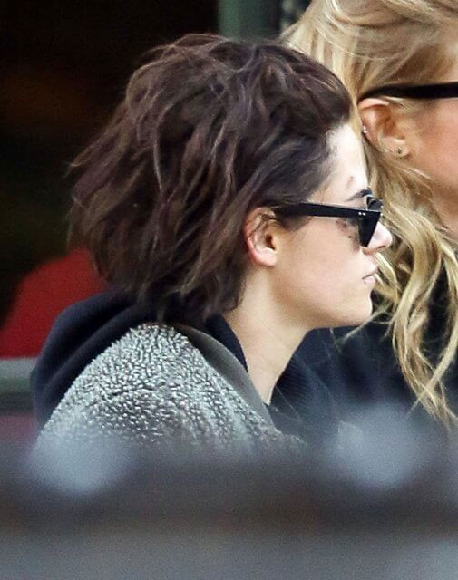 Dünyaca ünlü yıldız içler acısı halde şiddet mi gördü - Resim: 4