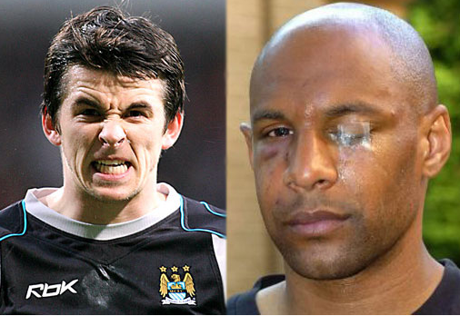 İki futbolcu birbirine girdi - Resim: 2