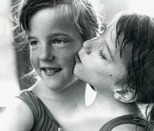 Bir vücutta iki hayat! Yapışık ikizleri dünya konuşuyor - Resim: 1