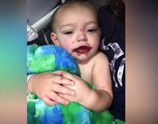 Çocuğunu bir anda bu halde buldu hastaneye koştu gerçekler acı! - Resim: 3